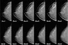 compare-tomosynthesis