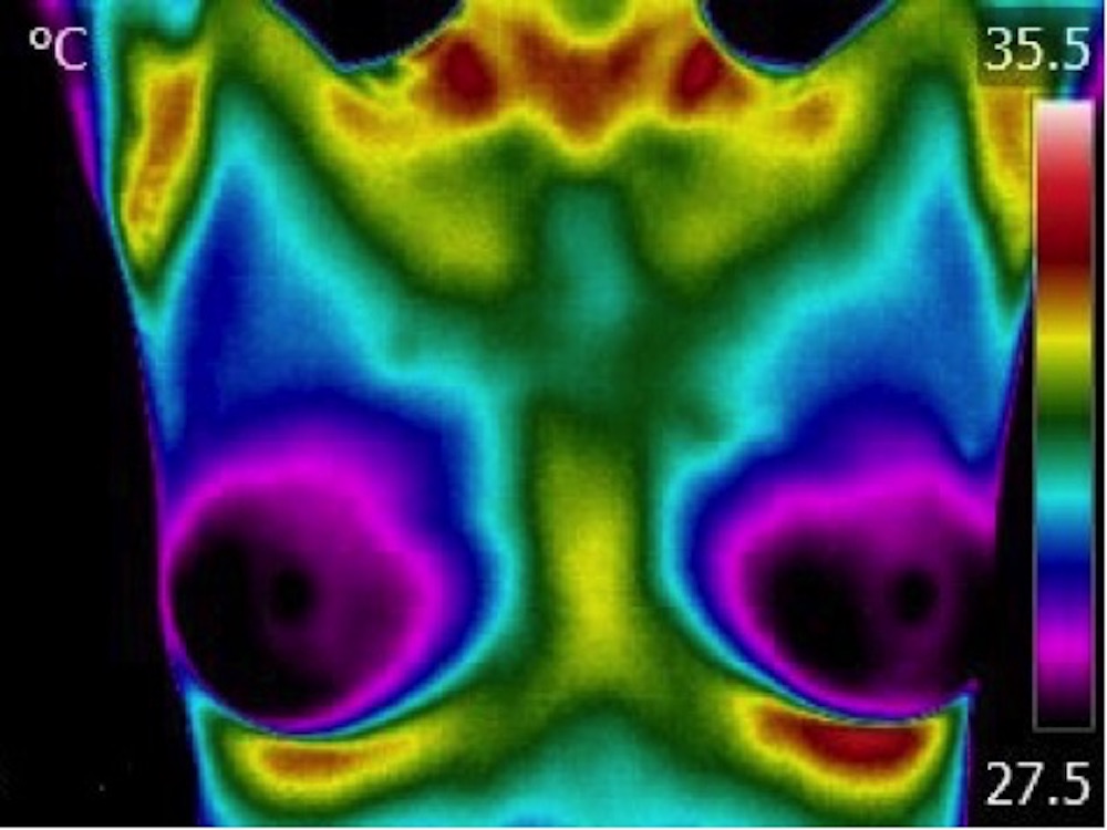 Seeing is Believing Breast Thermal Image in Rainbow
