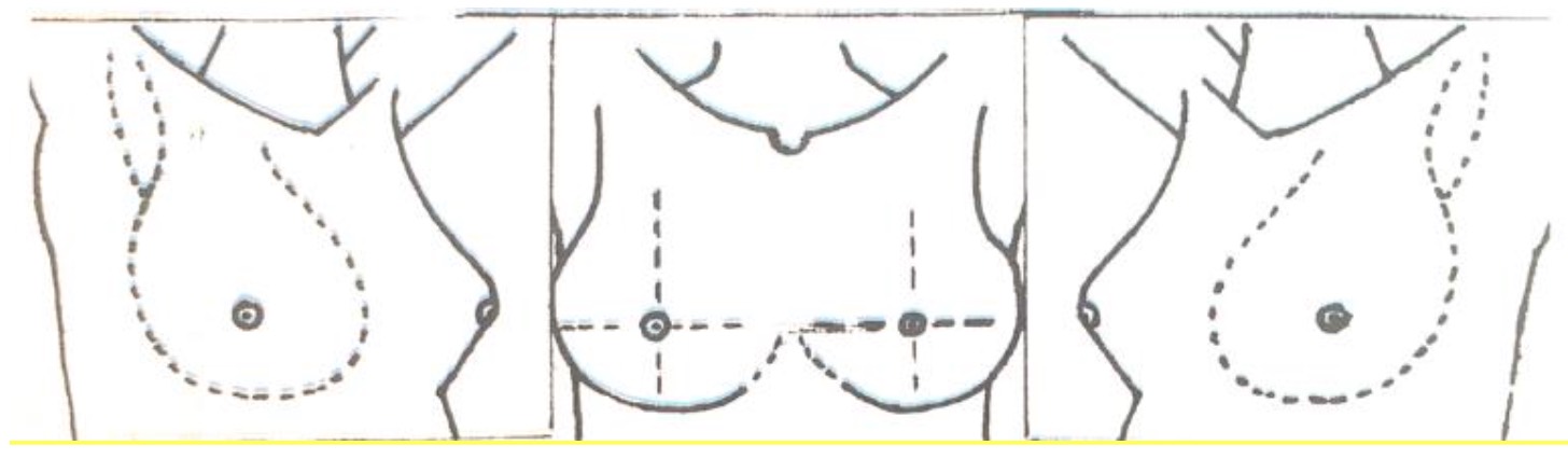 Breast Diagram